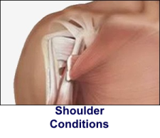 Shoulder Conditions